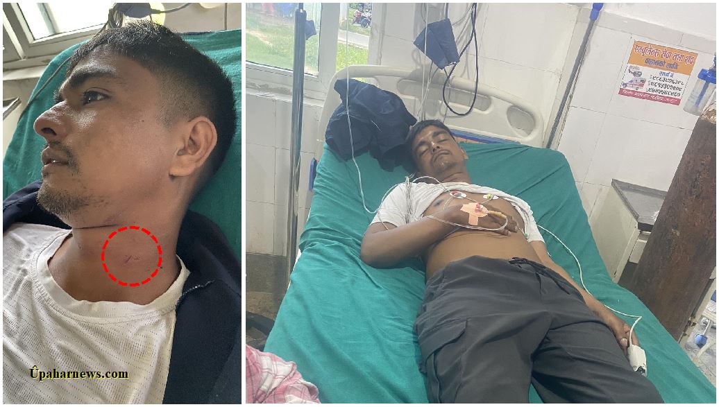 उदयपुरमा विद्युत प्राधिकरणको लापरबाही, रास्वपा जिल्ला सभापति कार्की घाइते